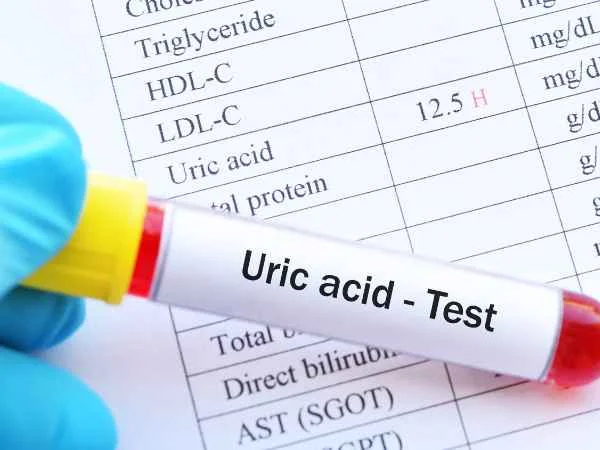 Tips to Control Uric Acid_ Causes, Symptoms, and Risks