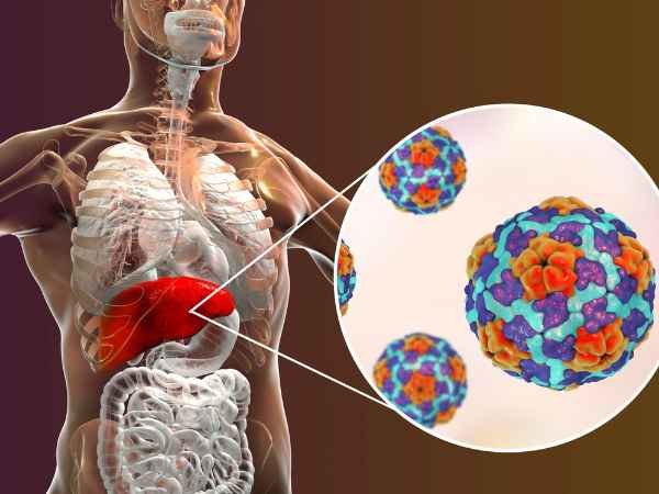 Understanding Hepatitis_ What You Need to Know