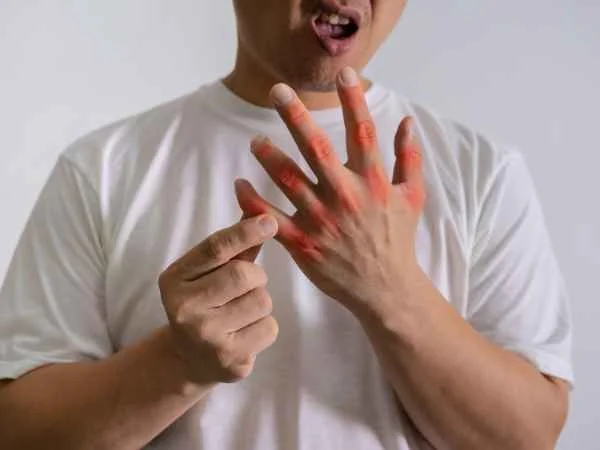 What Causes High Uric Acid in the Human Body