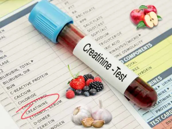 10 Foods to Reduce High Creatinine Levels for a Healthy Life