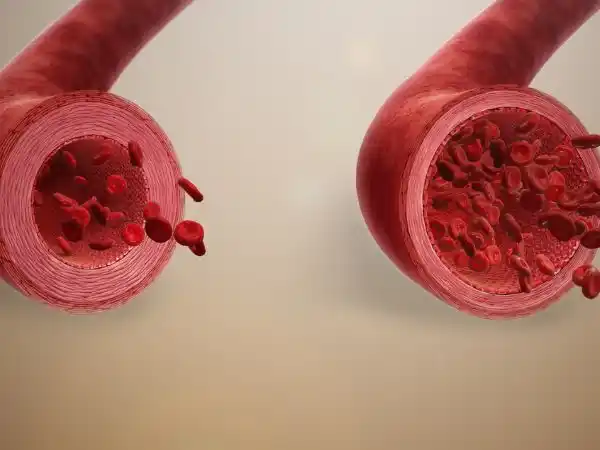 Cold Weather Constricts Blood Vessels