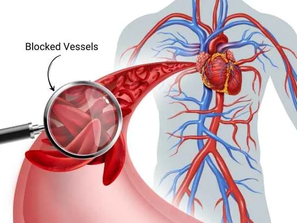 Poor Blood Circulation Symptoms, Causes & Treatments