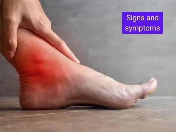 Signs and symptoms of Poor Blood Circulation