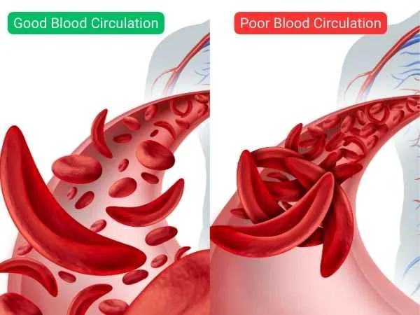 What is Poor Blood Circulation
