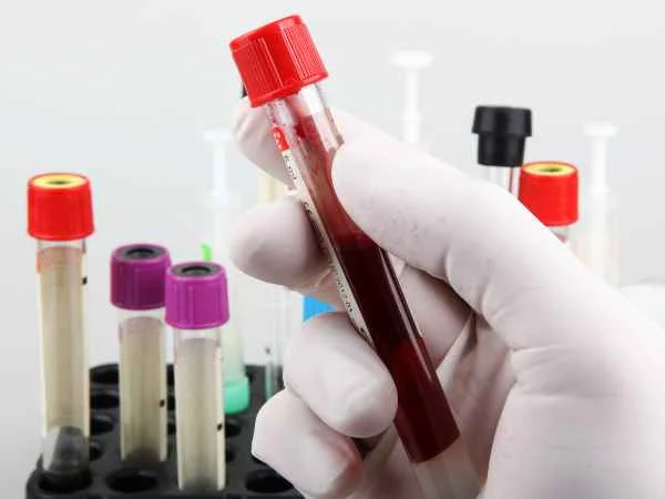 Blood Testing