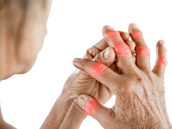 Gout and Uric Acid