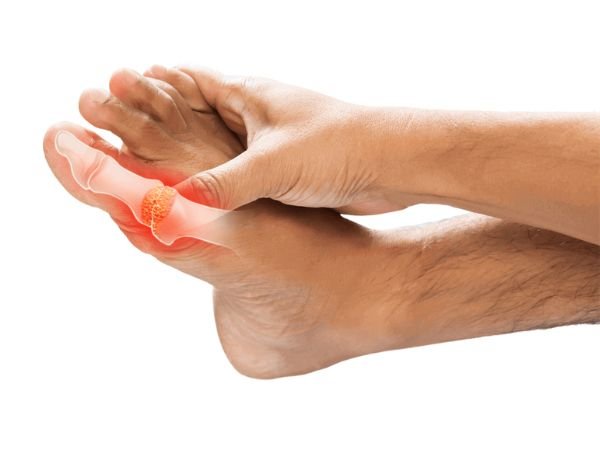 Why should the body manage uric acid
