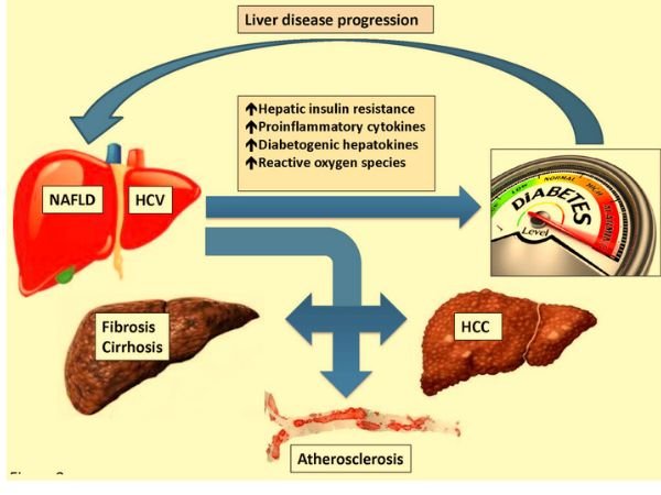 The Relationship Between Diabetes and Liver Disease