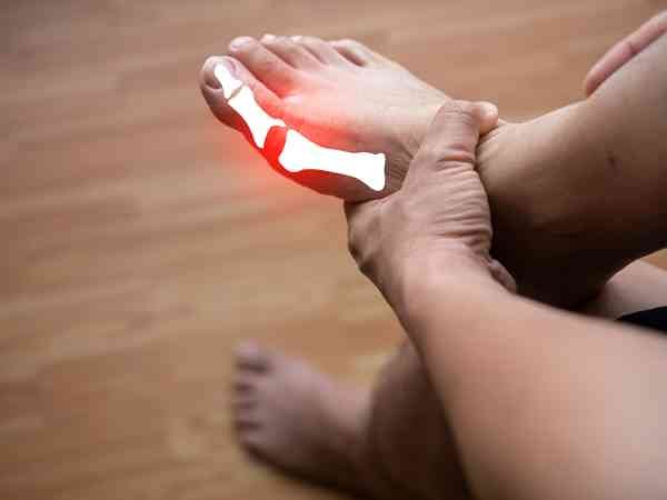 Understanding Uric Acid and Its Effect