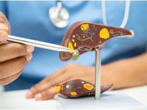 Etiology of Chronic Liver Parenchymal Disease