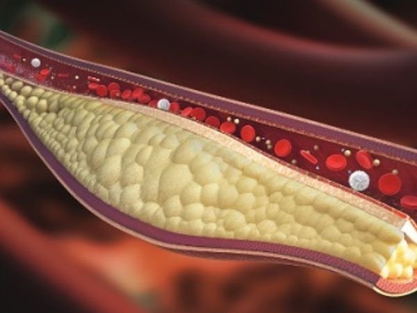 Lowers Bad Cholesterol