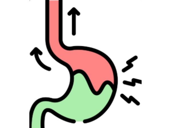 Gastroesophageal Reflux Disease