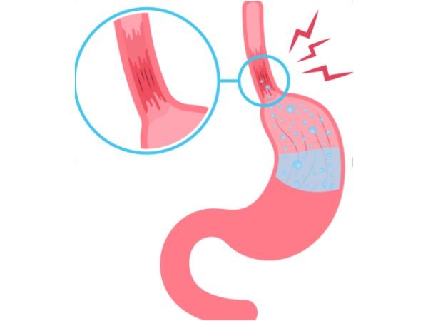 Physical or Medical Causes