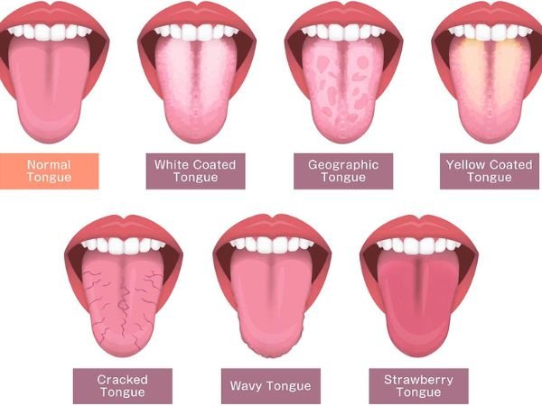 Tongue_ Your Body's Reflective Mirror