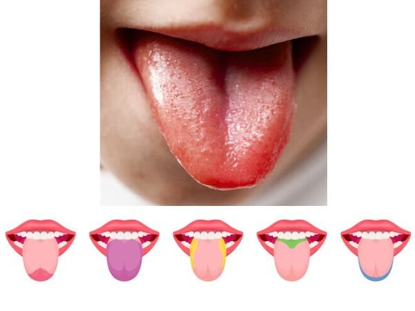 What Various Tongue Colors Might Indicate