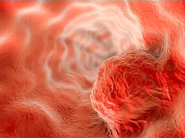 What is the first warning sign of Esophageal Cancer