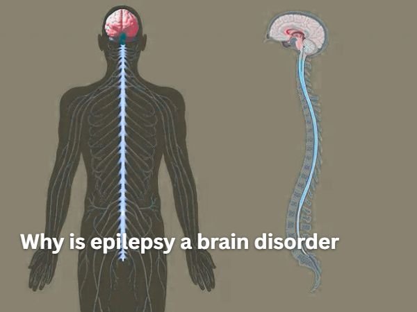 Why is epilepsy a brain disorder