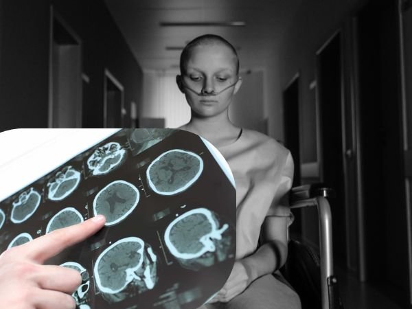 Can Brain Dead Patients Recover