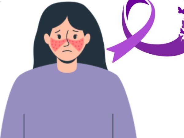 Lupus Disease and Symptoms