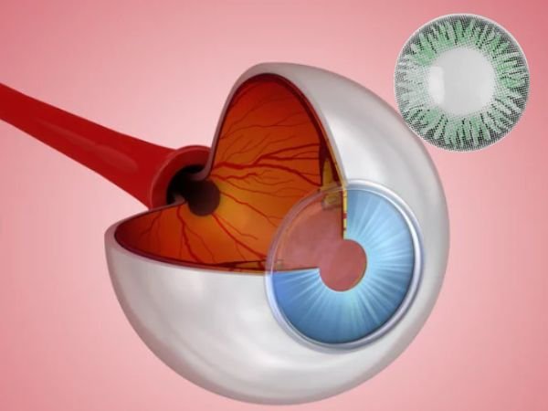 Understanding the Cornea