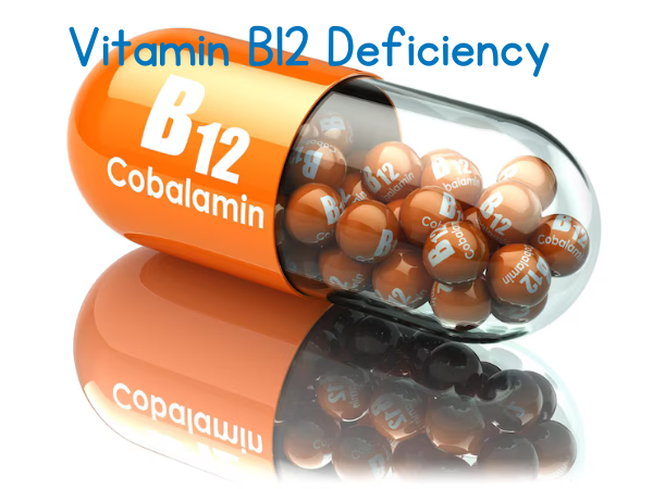 Vitamin B12 Deficiency