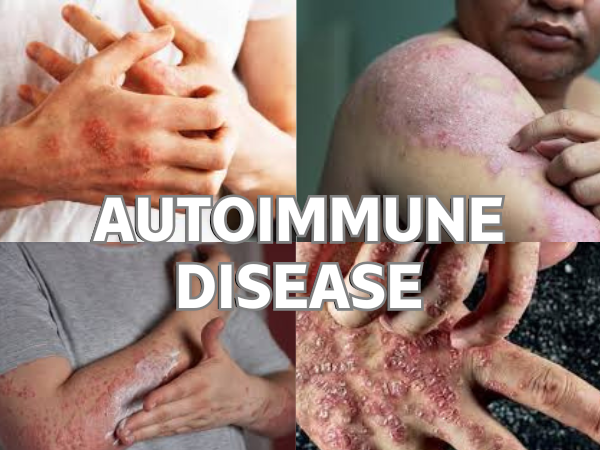 Autoimmune Disease