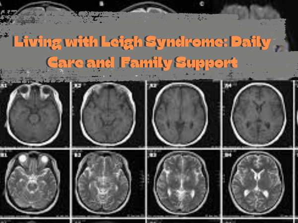 Living with Leigh Syndrome Daily Care and Family Support