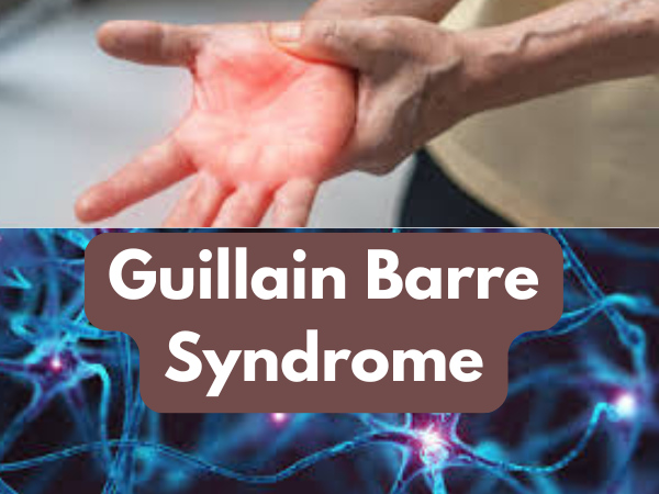 guillain barre syndrome